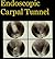 Endoscopic Carpal Tunnel Release handout (Surgery of the Hand, Wrist and Upper Extremity Book 1)