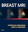 Breast MRI