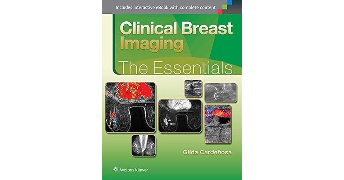 Clinical Breast Imaging The Essentials By Gilda Cardenosa