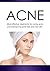 CLEAR SKIN: ACNE and SKIN CARE, causes, remedies, and treatments for PERFECT SKIN (beauty tips, acne cure, acne treatments, skin diet, acne care, acne remedies, facial)