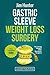Gastric Sleeve Weight Loss Surgery by Jim Hunter