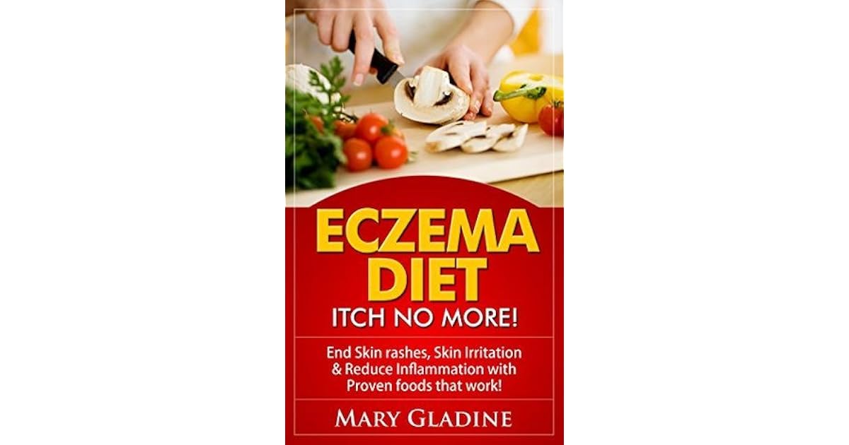Eczema Diet Itch No More! End Skin rashes, Skin Irritation & Reduce