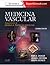 Medicina vascular: Complemento de Braunwald. Tratado de Cardiología (Spanish Edition)