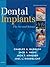 Dental Implants: The Art an...
