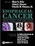 Esophageal Cancer: Principles and Practice