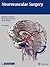 Neurovascular Surgery