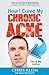 How I Cured My Chronic Acne by Chris Klein