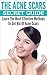 The Acne Scars Secret Guide...