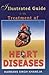 Illustrated Guide to the Treatment of Heart Diseases