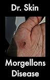 Morgellons Disease