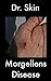 Morgellons Disease