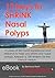 12 keys to Shrinking Nasal Polyps by Bertrand Waterman