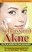 Schluss mit Akne! by Andy Ledwig