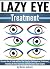 Lazy Eye Treatment: Discover How to Treat and Cure Your Lazy Eye (Amblyopia or Strabismus), Including At-Home Exercises and Information about Surgery