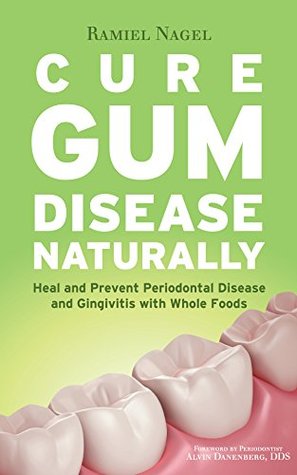 Cure Gum Disease Naturally: Heal and Prevent Periodontal Disease and Gingivitis with Whole Foods (Kindle Edition)