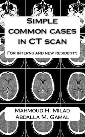 Simple common cases in CT scan: For interns and new residents