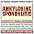 21st Century Complete Medical Guide to Ankylosing Spondylitis, Authoritative CDC, NIH, and FDA Documents, Clinical References, and Practical Information for Patients and Physicians (CD-ROM)