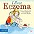 I Have Eczema (Coping with Chronic Conditions for Preschoolers)