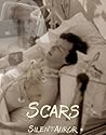 Scars Scars