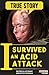 I Survived an Acid Attack: The tragic testimony of a woman who went through hell and back