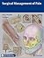 Surgical Management of Pain