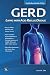GERD: Living With Acid Reflux Disease (MyModernHealth FAQs)