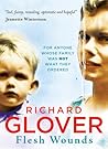 Flesh Wounds by Richard Glover