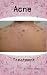 Acne Treatment