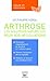 L'Arthrose - Les solutions naturelles pour vos articulations (NATURE & VITAMI) (French Edition)
