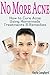 No More Acne: How to Cure A...