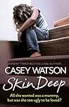 Skin Deep by Casey Watson
