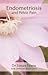 Endometriosis And Pelvic Pain