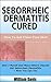 Seborrheic Dermatitis Cured...