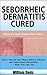 Seborrheic Dermatitis Cured by William Davis
