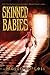 Skinned Babies by Mason Burgess