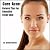 Cure Acne: Natural Tips for...