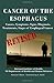 Cancer Of The Esophagus: Causes, Symptoms, Signs, Diagnosis, Treatments, Stages of Esophageal Cancer