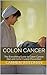 Colon Cancer: The Everything Guide to Colon Cancer Diet and Colon Cancer Prevention