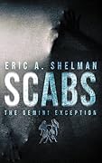 Scabs: The Gemini Exception