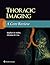 Thoracic Imaging: A Core Review