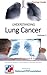 UNDERSTANDING Lung Cancer | Signs, Symptoms, Treatment & Prevention: A Quick Guide to Lung Cancer
