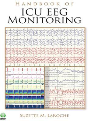 Handbook of ICU EEG Monitoring E-Book