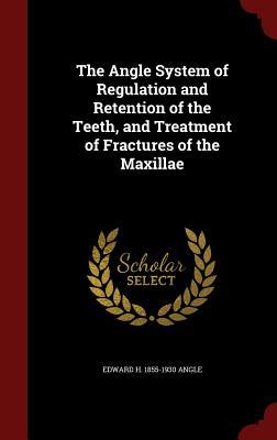 The Angle System of Regulation and Retention of the Teeth, and Treatment of Fractures of the Maxillae