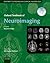 Oxford Textbook of Neuroimaging by Massimo Filippi