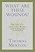 What Are These Wounds?: The Life of a Cistercian Mystic Saint Lutgarde of Aywières