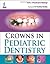 Crowns in Pediatric Dentistry