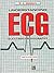 Understanding ECG Electrocardiography