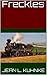 Freckles