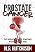 Prostate cancer: The overview, causes, symptoms, preventions and cure (Dealing With Cancer Book 2)