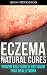 Eczema Natural Cures: Prove...
